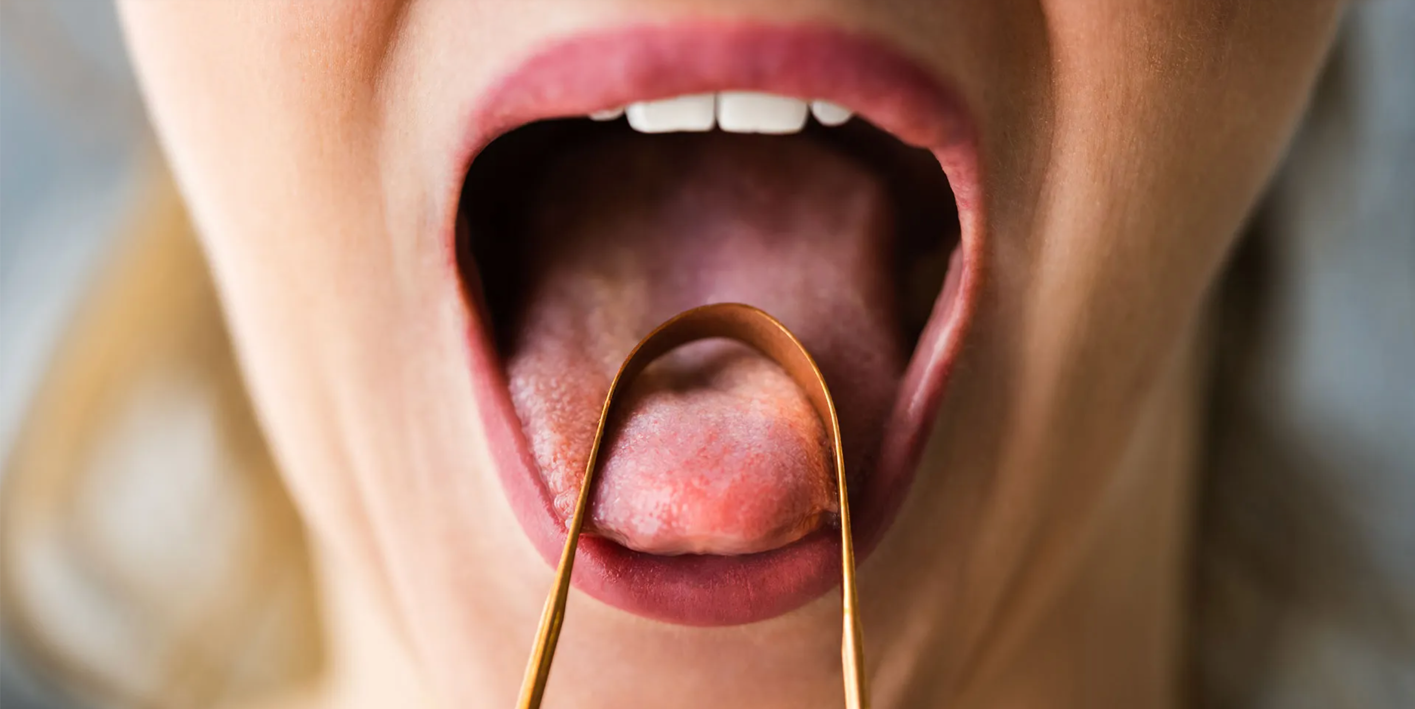 Tongue Scraper